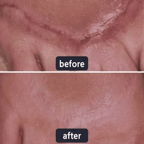 Mother’s Day Special: 70% OFF 🎁 DEA™ Scar Repair Cream — Smooth, Clear, Confident Skin
