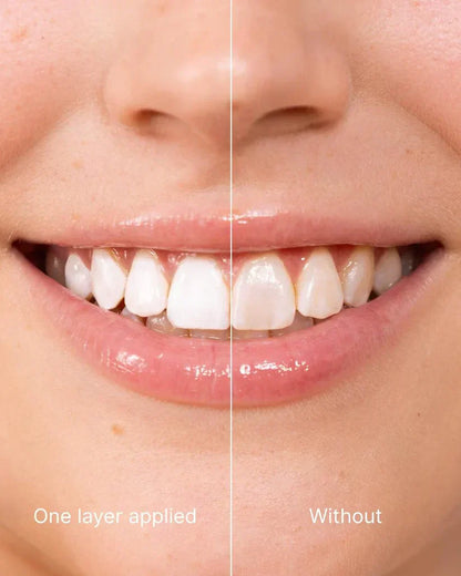 Final 3 Hours! 丨DEA™Tooth Polish - Instant Clean Smile