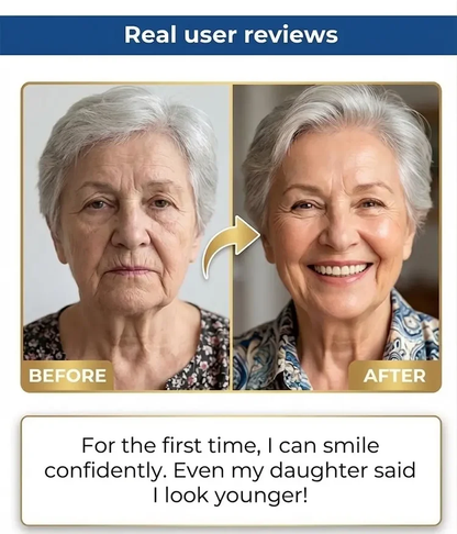 🏆Ends Today: 50% OFF! 🏆2026 Bestselling Product🦷 Fit for a Fresh Smile, Say Goodbye to Wearing Discomfort!