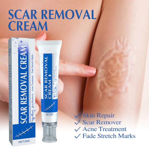 Mother’s Day Special: 70% OFF 🎁 DEA™ Scar Repair Cream — Smooth, Clear, Confident Skin