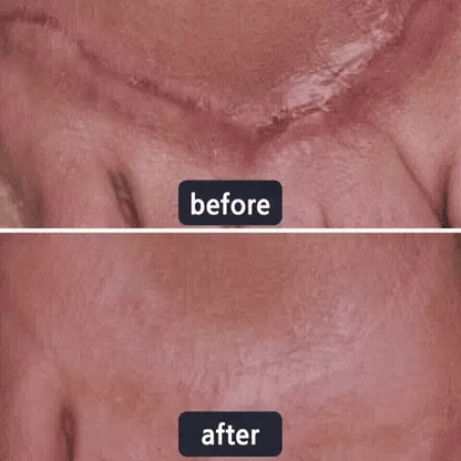 Mother’s Day Special: 70% OFF 🎁 DEA™ Scar Repair Cream — Smooth, Clear, Confident Skin