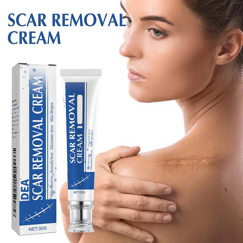 Mother’s Day Special: 70% OFF 🎁 DEA™ Scar Repair Cream — Smooth, Clear, Confident Skin