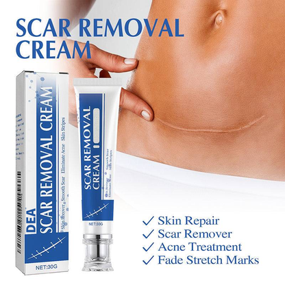 Mother’s Day Special: 70% OFF 🎁 DEA™ Scar Repair Cream — Smooth, Clear, Confident Skin