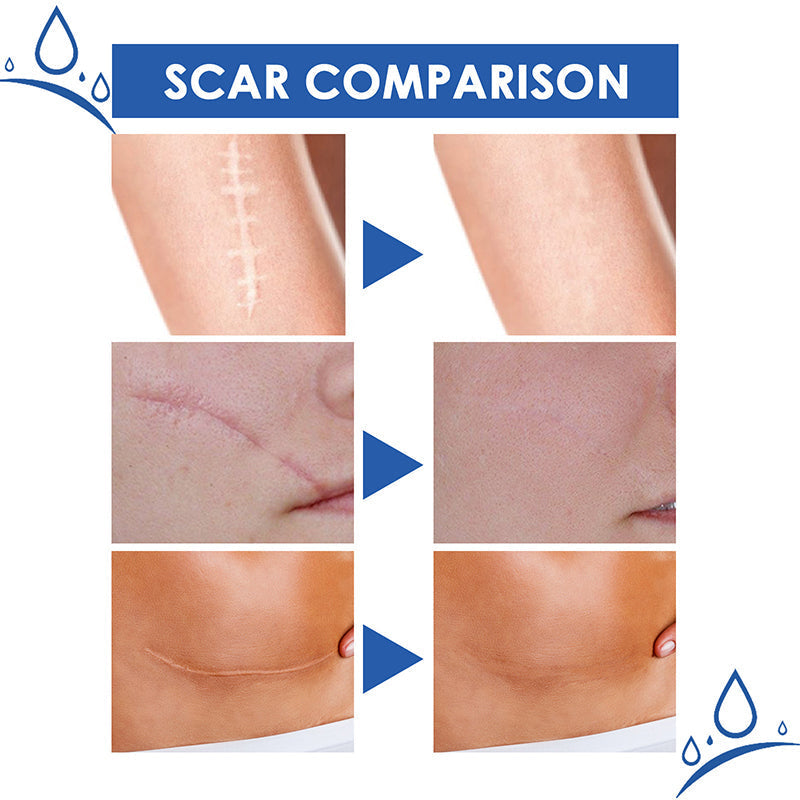 Mother’s Day Special: 70% OFF 🎁 DEA™ Scar Repair Cream — Smooth, Clear, Confident Skin