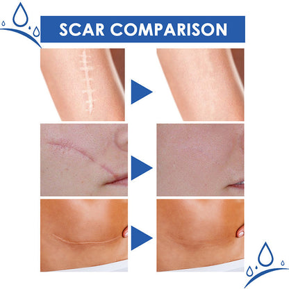 Mother’s Day Special: 70% OFF 🎁 DEA™ Scar Repair Cream — Smooth, Clear, Confident Skin