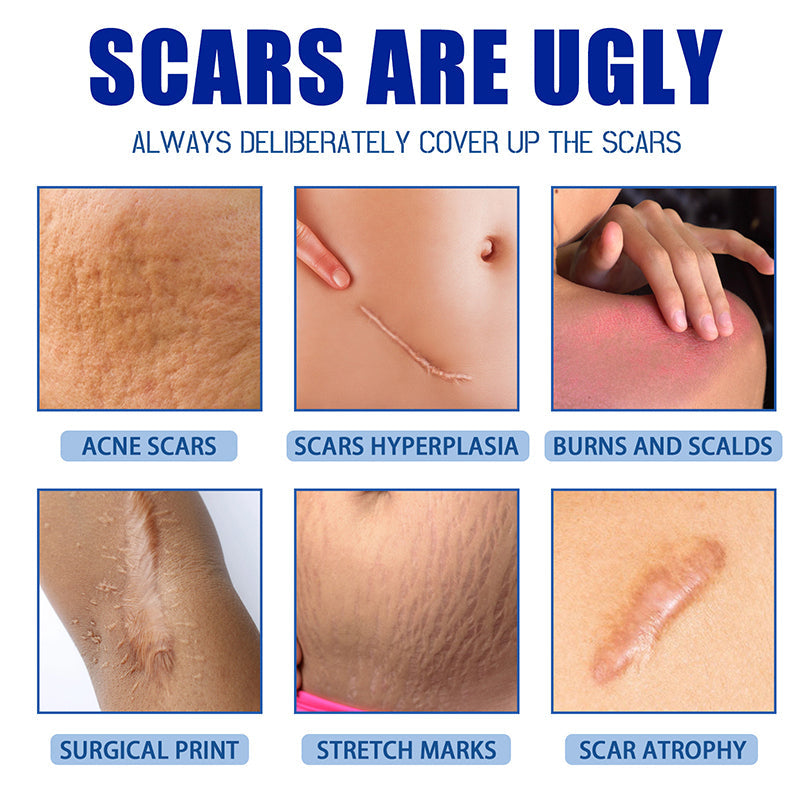 Mother’s Day Special: 70% OFF 🎁 DEA™ Scar Repair Cream — Smooth, Clear, Confident Skin
